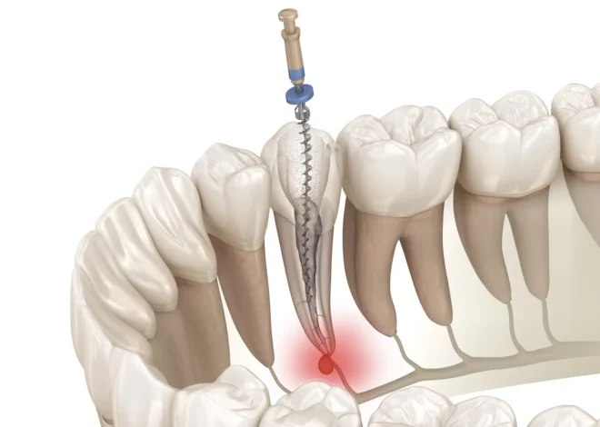 How Endodontists Use Advanced Microscopy to Save Teeth That General Dentists Cannot Treat