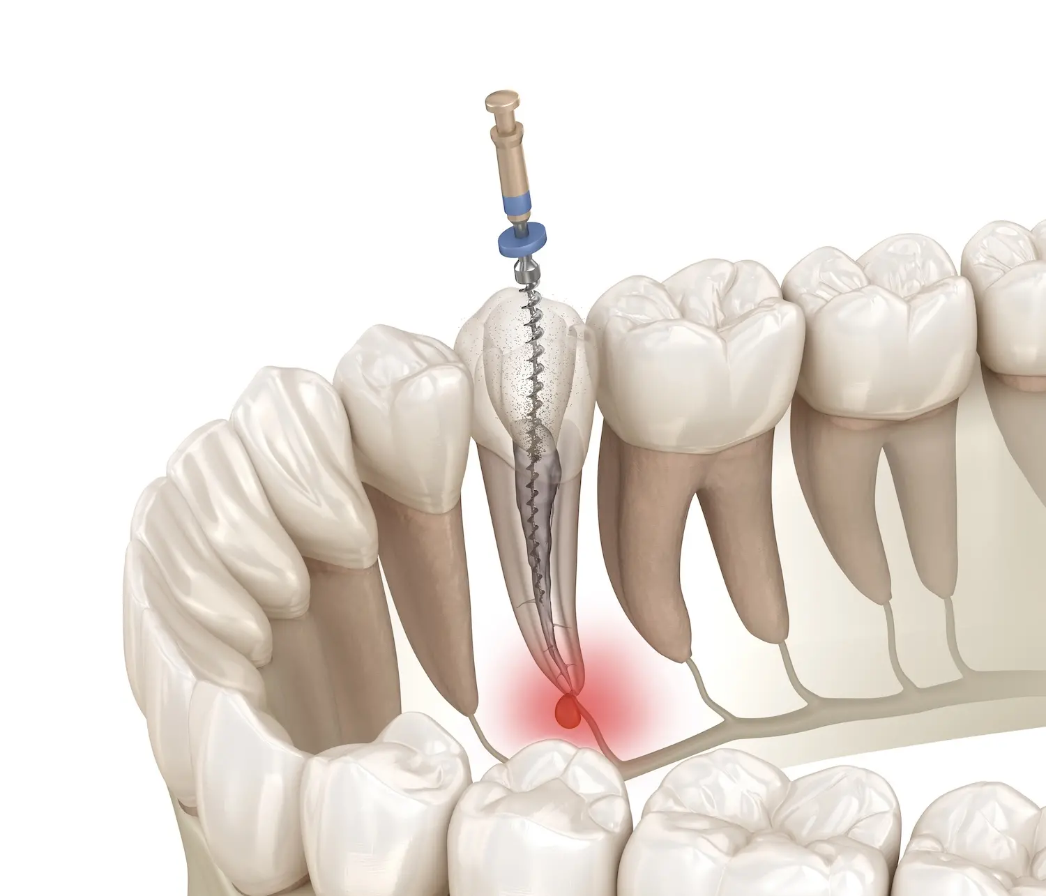 How Endodontists Use Advanced Microscopy to Save Teeth That General Dentists Cannot Treat